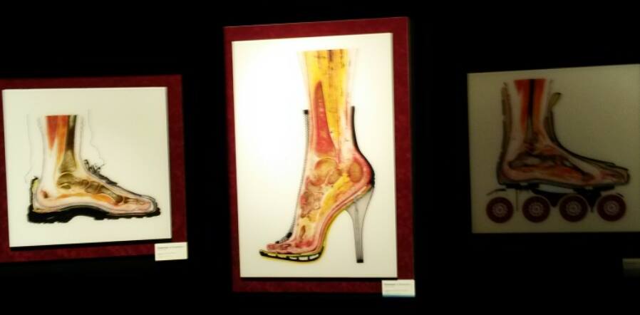 Gunther von Hagens’ & His Body Worlds Exhibit in Berlin